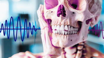 APOYO DESORDEN MANDIBULAR