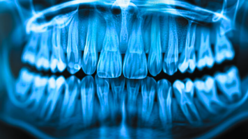 CALMA INFECCION DENTAL 